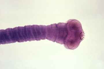 Scolex of the parasitic pork tape worm, Taenia solium. ID# 14377, http://phil.cdc.gov/phil/details.asp