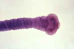 Scolex of the parasitic pork tape worm, Taenia solium. ID# 14377, http://phil.cdc.gov/phil/details.asp