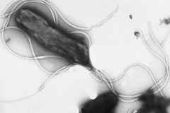 Electron micrograph of H. pylori possessing multiple flagella (negative staining) / wikipedia