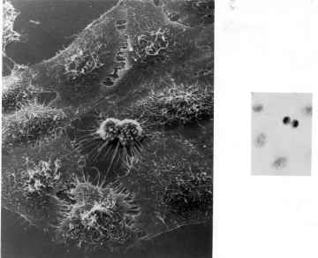 Podział komórek HeLa pod mikroskopem elektronowym http://pl.wikipedia.org/