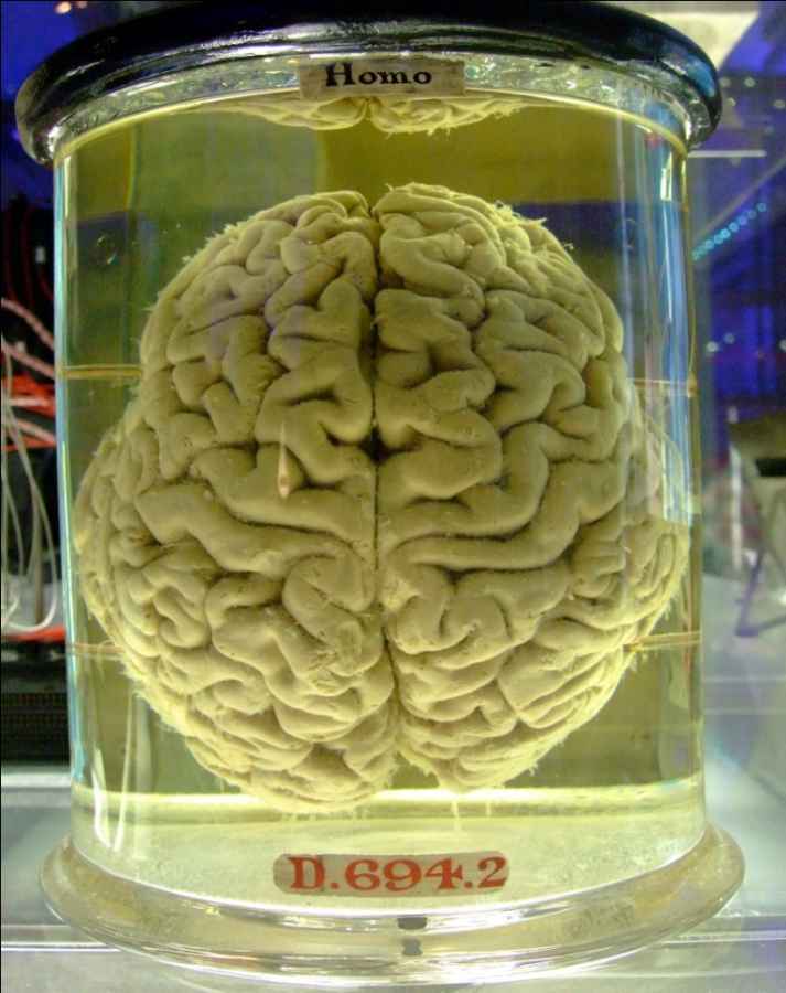 Human_brain_in_a_vat.jpg